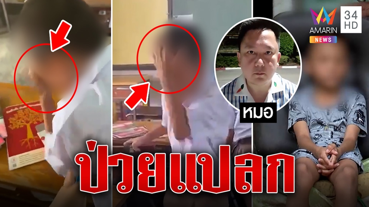 7 ขวบป่วยประหลาดนั่งตบหน้าตัวเองทั้งวัน หมอแนะให้พาพบแพทย์