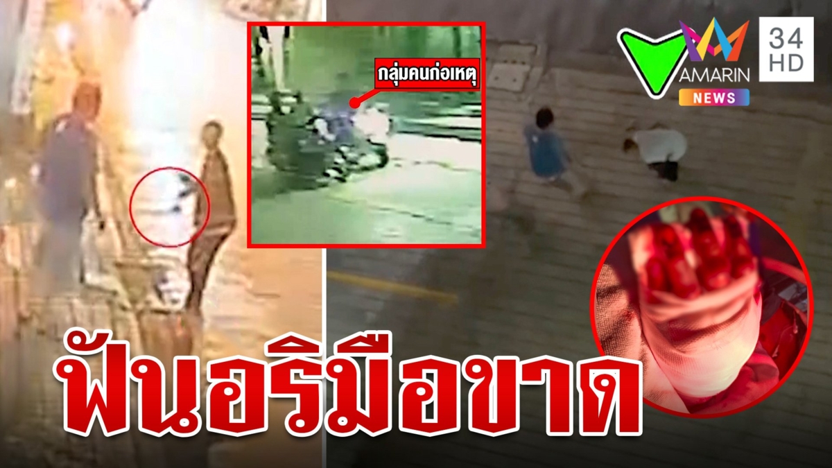 3 พี่น้องเหี้ยม ดาบฟันอริวัย 15 มือขาด พลเมืองดีช่วยเก็บมือแช่น้ำแข็ง เร่งส่งรพ. ต่อสำเร็จ