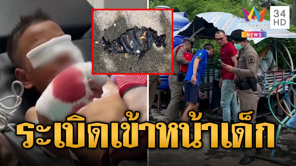 6 ขวบเจอกระเป๋าปริศนาในสนามเด็กเล่น เปิดดูระเบิดบึ้มใส่หน้า ตัดนิ้วทิ้ง