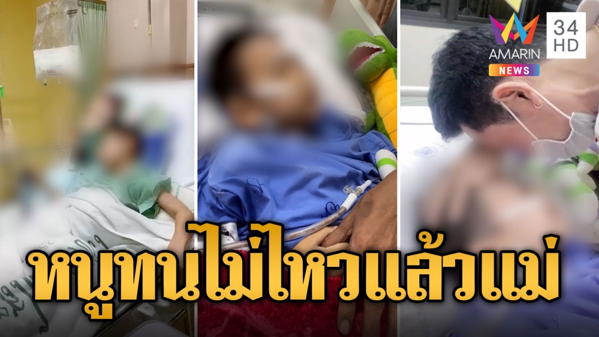 แม่ปวดหัวใจ! น้องไกด์ ถูกบัสทับต้องตัดขา ร้องลั่นสุดทรมาน