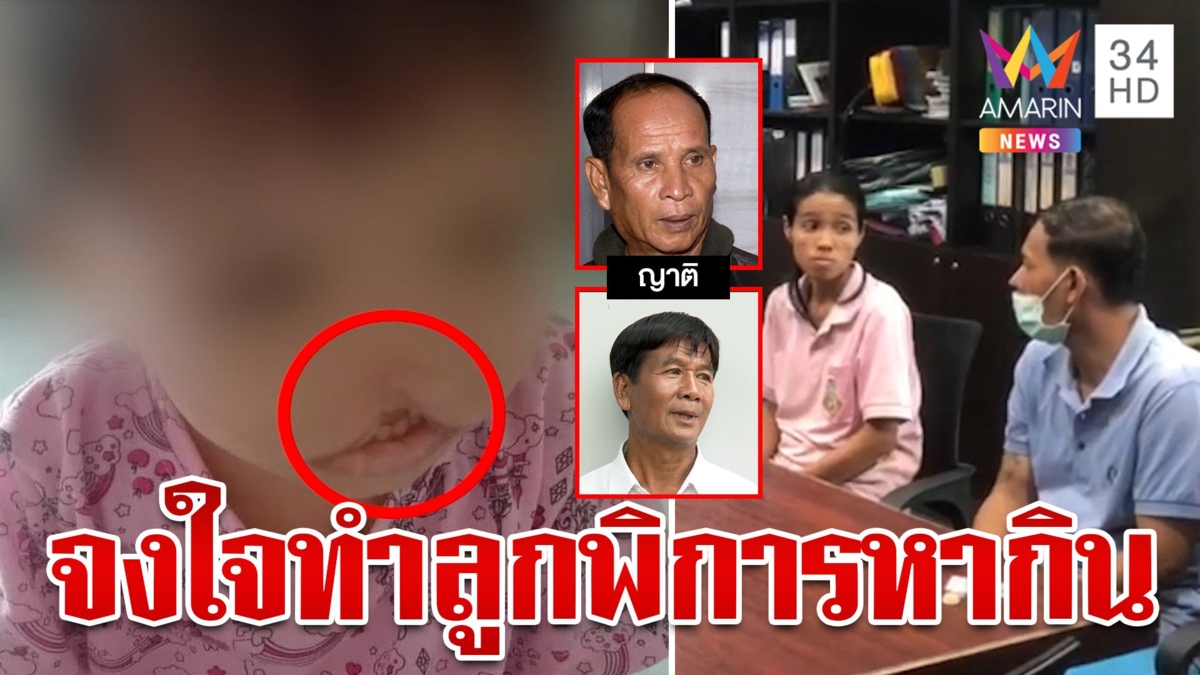 แฉวีรกรรม "ไอ้เอ็ม-เจษฎา" ผงะพ่อชั่วจงใจกรีดปากลูกโพสต์ขอเงินช่วยเหลือ