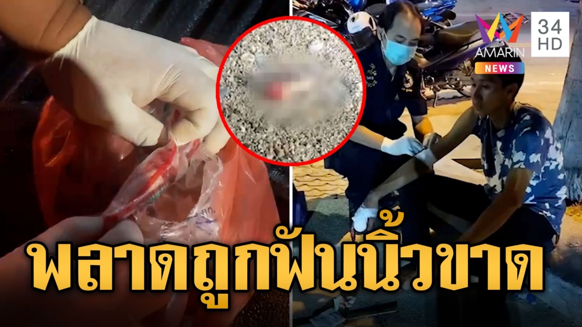 หนุ่มควงอีโต้ลุยสางแค้นให้น้อง พลาดท่าคู่อริฟันนิ้วขาด