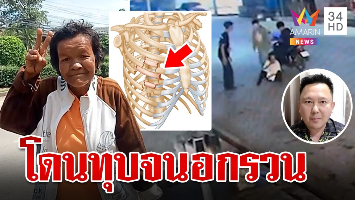 สะเทือนใจ! ผลชันสูตร “ป้ากบ” เลือดออกสมอง โดนทุบจนอกรวน