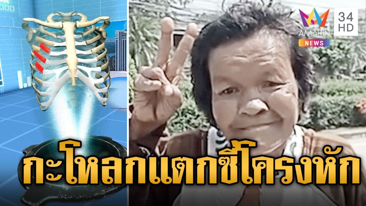 เปิดผลชันสูตร "ป้าบัวผัน" กระทืบแรงกะโหลกแตก ซี่โครงหักจนสิ้นใจตาย