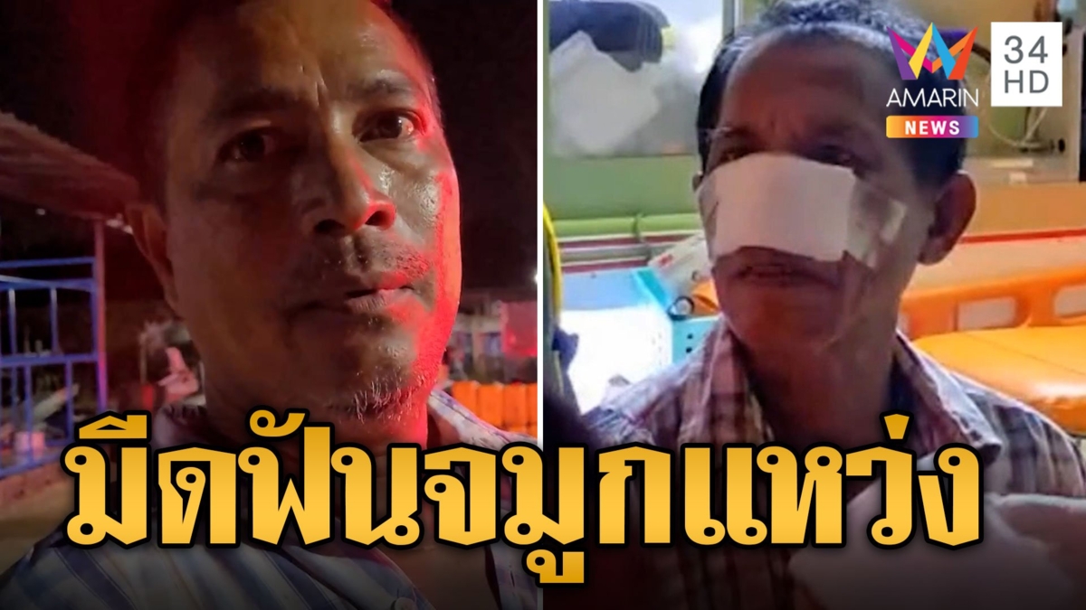 หนุ่มใหญ่ร่วมวงเหล้าเดือดพูดไม่เข้าหู ต่อยกันนัวก่อนคว้ามีดฟันจมูก