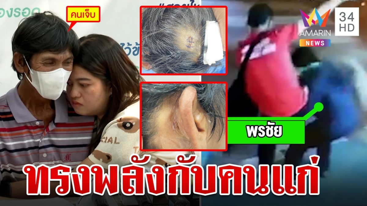 รปภ.โหดกระทืบคนแก่พิการ ลูกสาวหอบหลักฐานร้องเพจสายไหมช่วย หลังแจ้งความแล้วคดีไม่คืบ