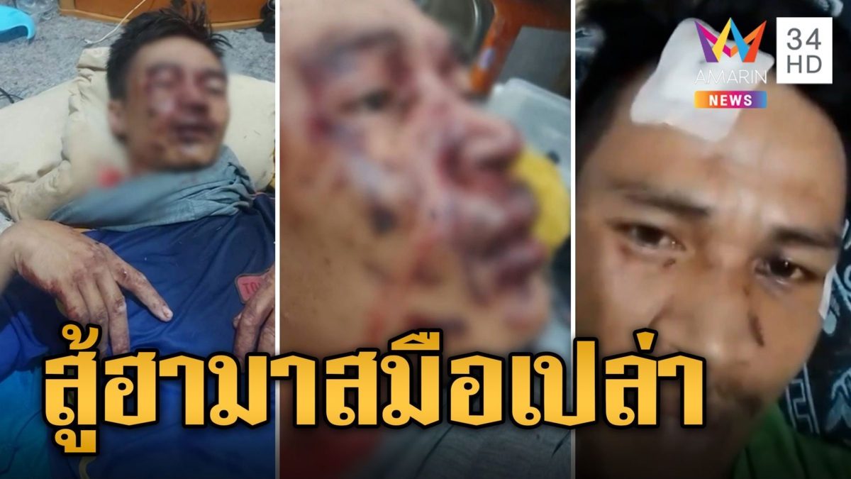 หนุ่มไทยสู้ฮามาสมือเปล่า โดนปาดคอยื้อเป็นชั่วโมง สู้สุดใจถูกแทงจนเลือดท่วมฟื้นรอดปาฏิหาริย์