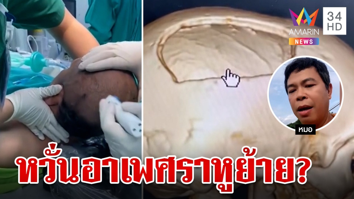 คนไข้เลื่อนผ่าตัดเพราะตรงวันราหูย้าย แฟนพันธุ์แท้จตุคามชี้ต้องเชื่อหมอ