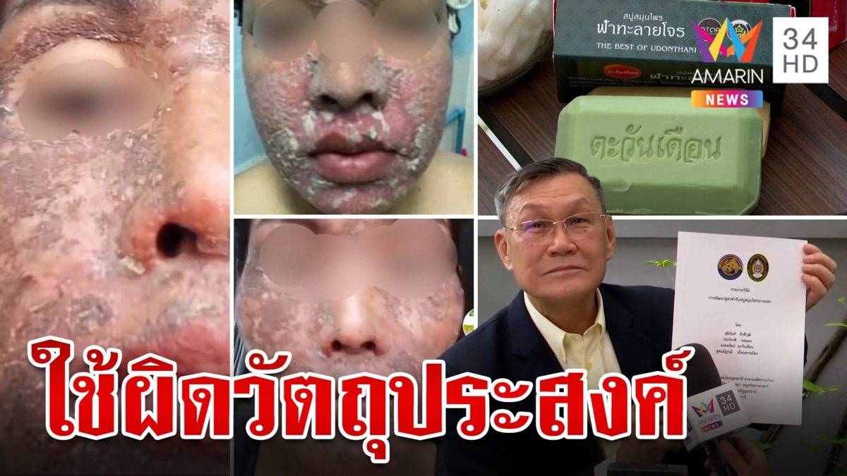 เจ้าของโร่แจง สบู่นางแซง ถูกรีวิวใช้ผิดวิธี อย. เตือนอย่าหลงเชื่ออ้างสรรพคุณเกินจริง