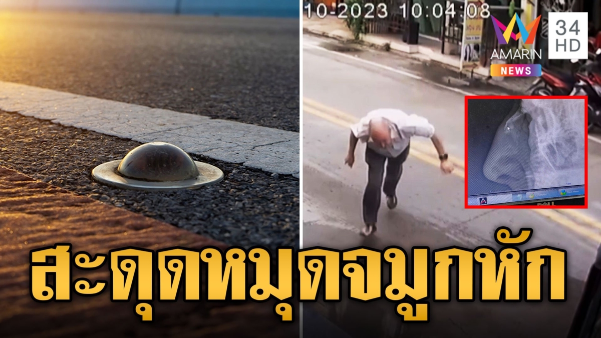 อันตราย! นทท.สะดุดหมุดลูกแก้วกลางนน หน้าทิ่มจมูกหัก ซี่โครงหัก