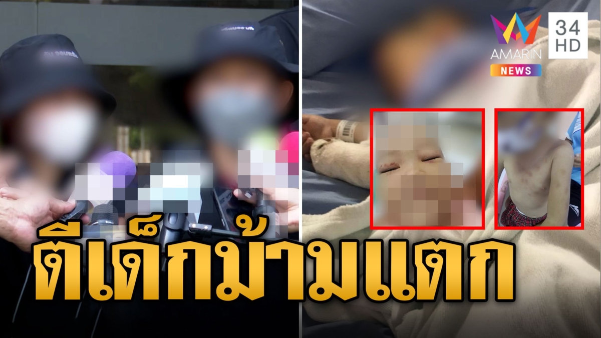 ญาติร้อง ช่วยหลาน 3 ขวบถูกแม่-พ่อเลี้ยงทำร้ายม้ามแตก