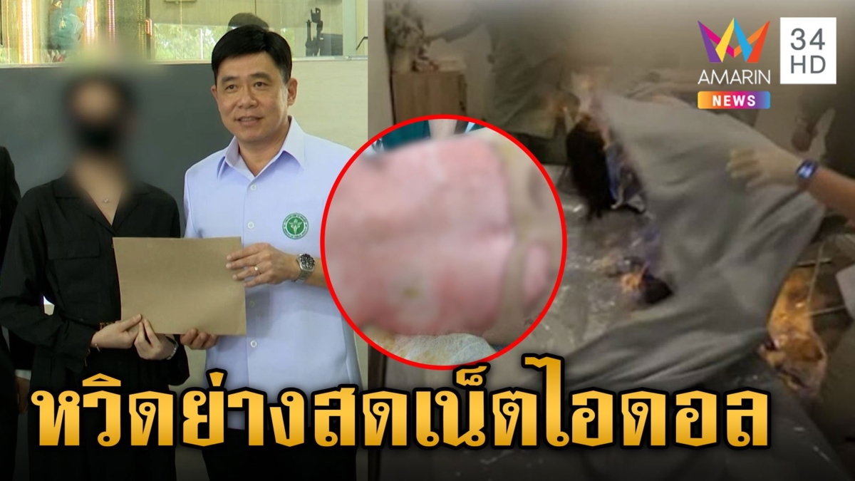 เน็ตไอดอลสาวรักษาด้วยวิธี "เผายาหน้าท้อง" ไฟลามลุกท่วม หมอไม่ช่วย เผ่นอย่างไว