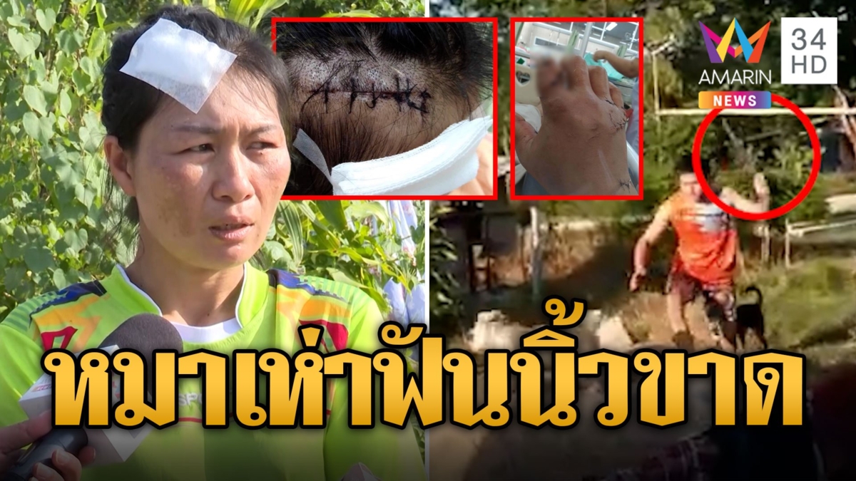 หนุ่มฉุนหมากัดเมีย ควงมีดดาบฟันหัว-นิ้วขาด