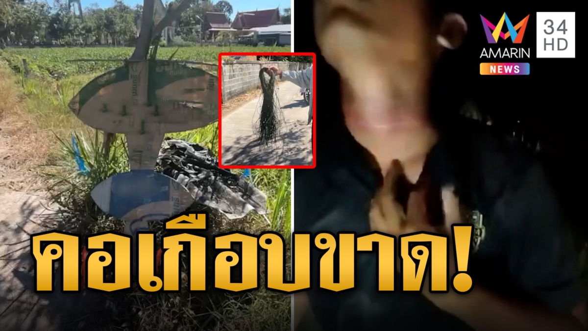 เสียวแทน! หนุ่มคอเกือบขาด ชาวบ้านผูกเชือกว่าวบาดคอลึก 1 เซนติเมตร