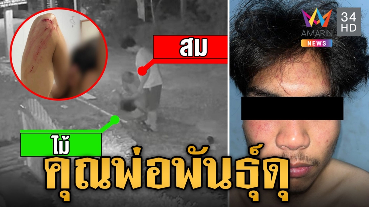 หนวดกระดิก! พ่อหวงลูกสาว ตื้บยับหนุ่ม 17 พาส่งบ้านผิดเวลา