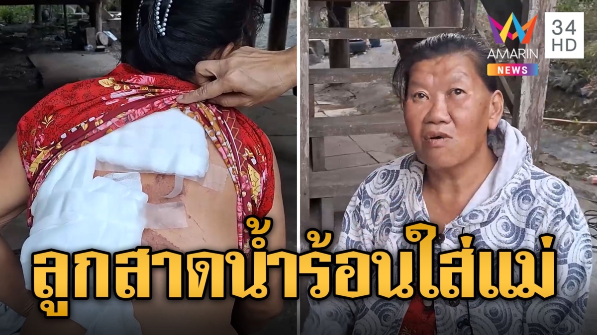 ลูกสาวทาสยา คว้าน้ำร้อนสาดหลังแม่แผลเหวอะ