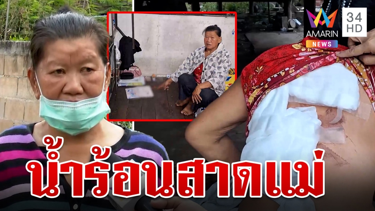 ลูกสาวใช้แม่ทำกับข้าวเสิร์ฟผัว หันมาเห็นแม่หน้าไม่ยิ้ม น้ำร้อนสาดบาดเจ็บ