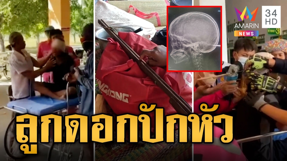 เด็ก 14 ห้าวเล่นปืนยิงหนู ลั่นลูกดอกฝังกะโหลกเพื่อนล้มคาที่ แม่เล่านาทีสยอง