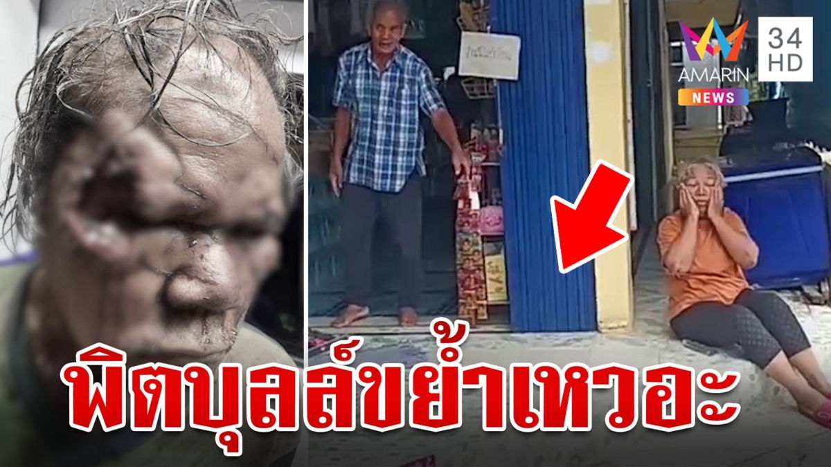 สยอง!พิตบุลล์ขย้ำตาวัย 63  ใบหน้าเหวอะ หูขาดทั้ง 2 ข้าง