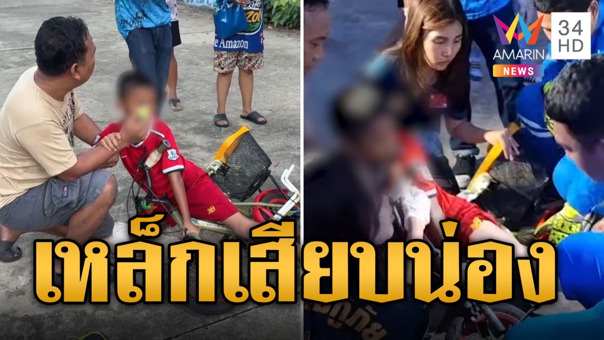 เด็กเคราะห์ร้าย ถูกที่ปั่นจักรยานเสียบน่อง