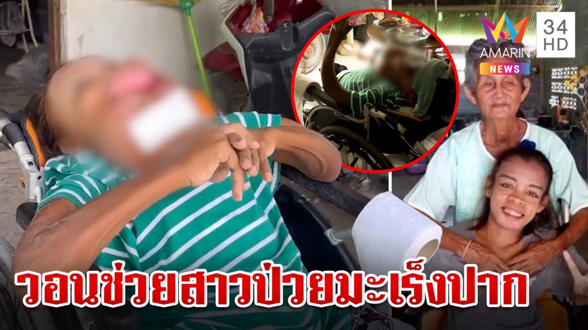 สุดรันทด!สาวป่วยมะเร็งปากชนิดหายาก แต่หัวใจยังสู้ วอนคนใจบุญช่วยเหลือ