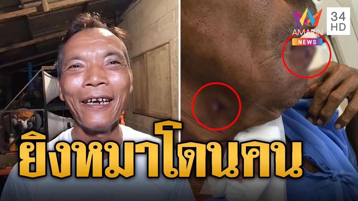 หนุ่มใหญ่ยิงหมา กระสุนเลยไปเจาะแก้มลุงเจ็บ