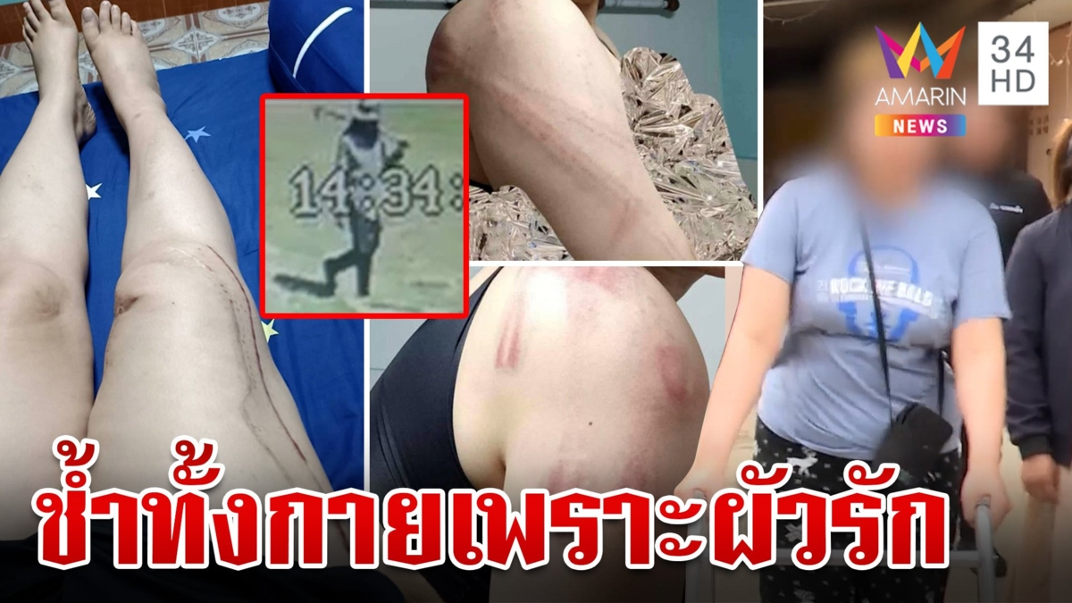 ขี้ยาใจเหี้ยมสายยางฟาดเมียพิการปางตาย กันรุดช่วยผัวโฉดหายล่องหน