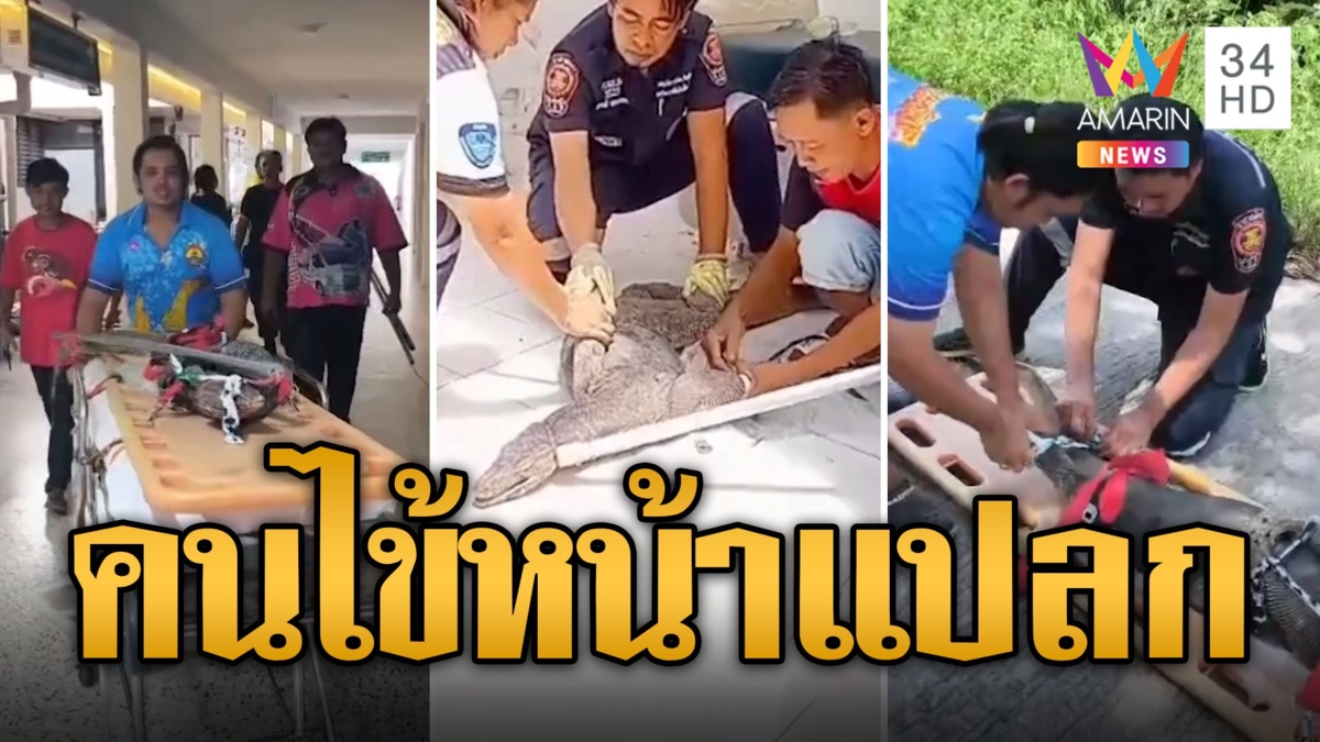 คนไข้หน้าแปลก! ตัวเหี้ยบุกรพ. จนท.จับขึ้นเตียงปล่อยธรรมชาติ