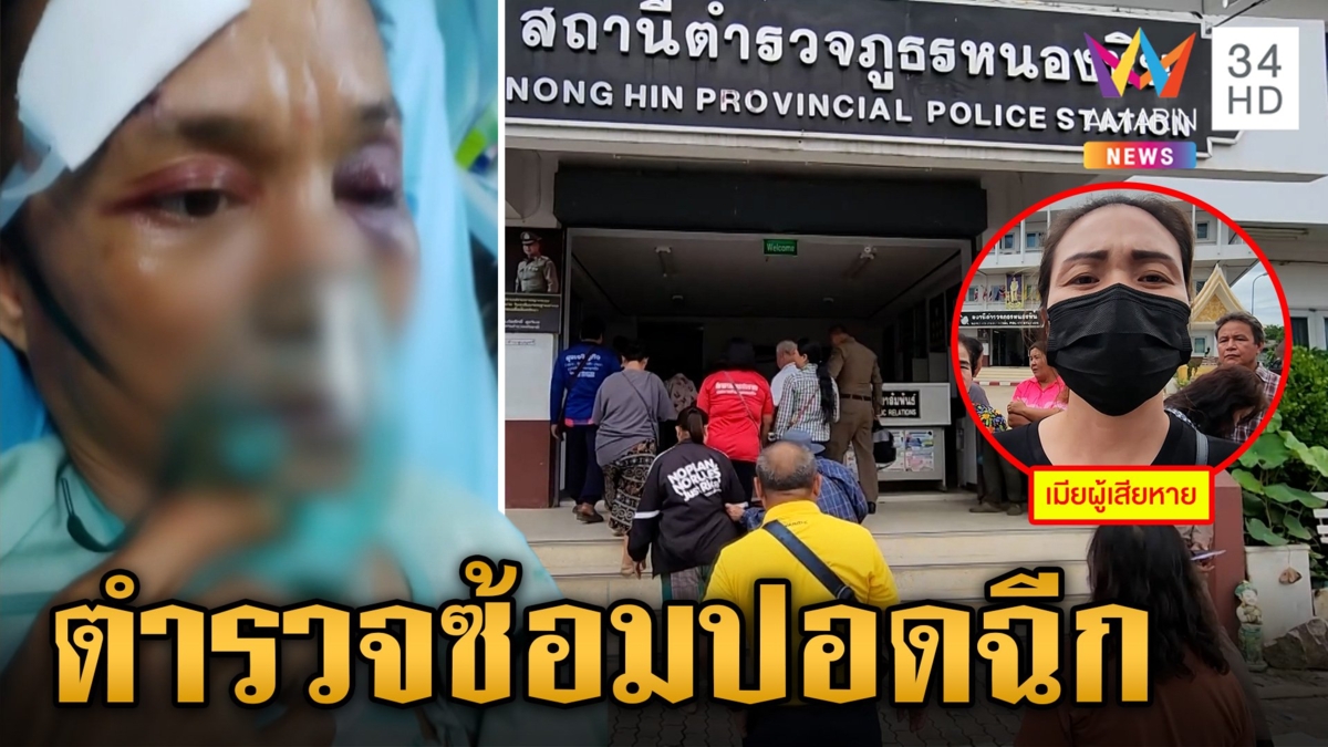 เมียบุกโรงพักเอาผิดตำรวจงามไส้ อุ้มซ้อมผัวจนปอดฉีก อ้างวิ่งชนโต๊ะ