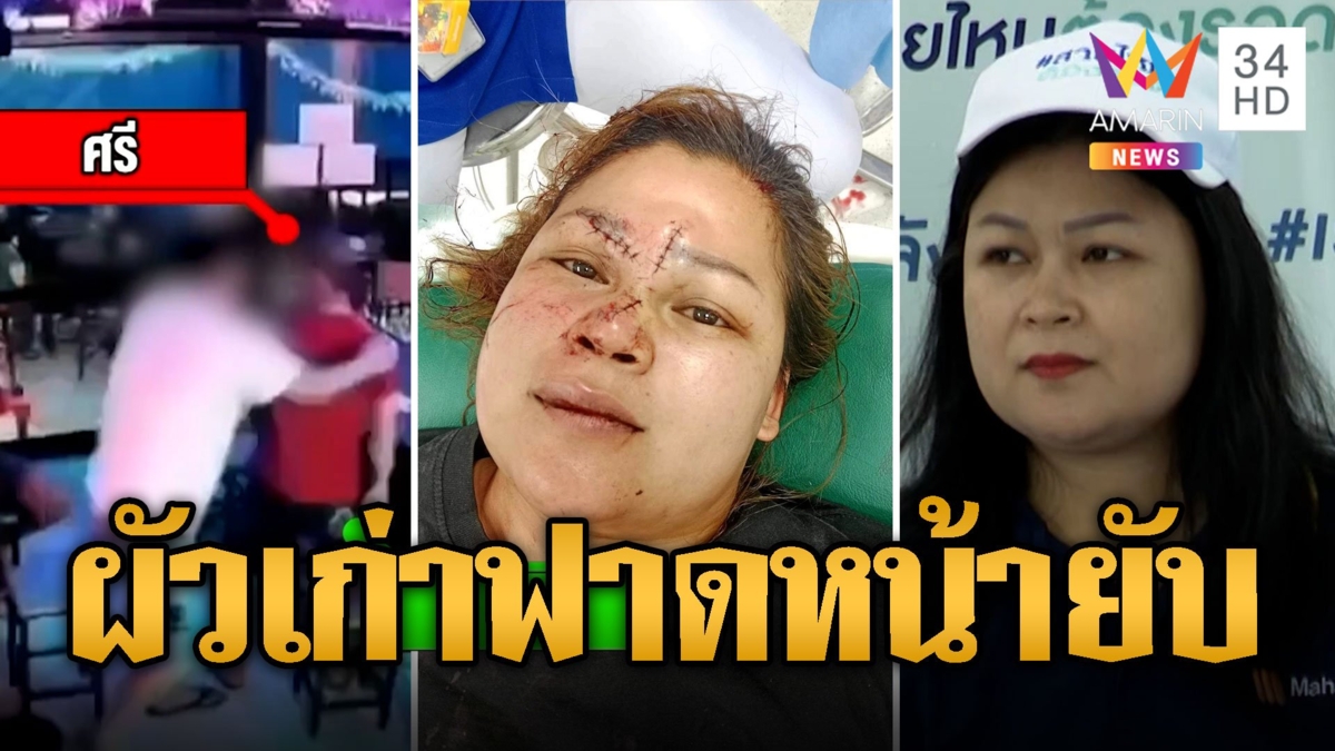 สาวร้องผัวเก่าตามราวี แก้วฟาดหน้าเย็บ 14 เข็ม