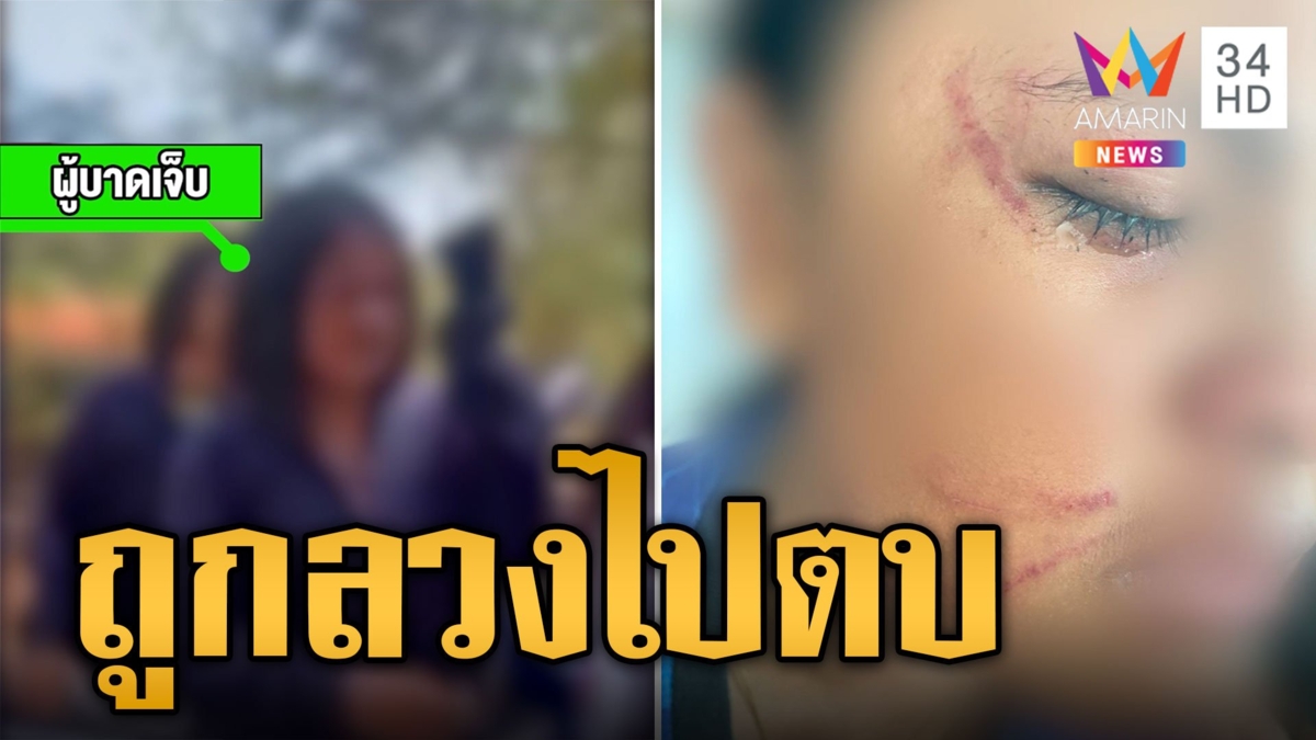 แม่ร้องลูก ม.2 ถูกเพื่อนลวงให้รุ่นพี่รุมตีหน้ายับ