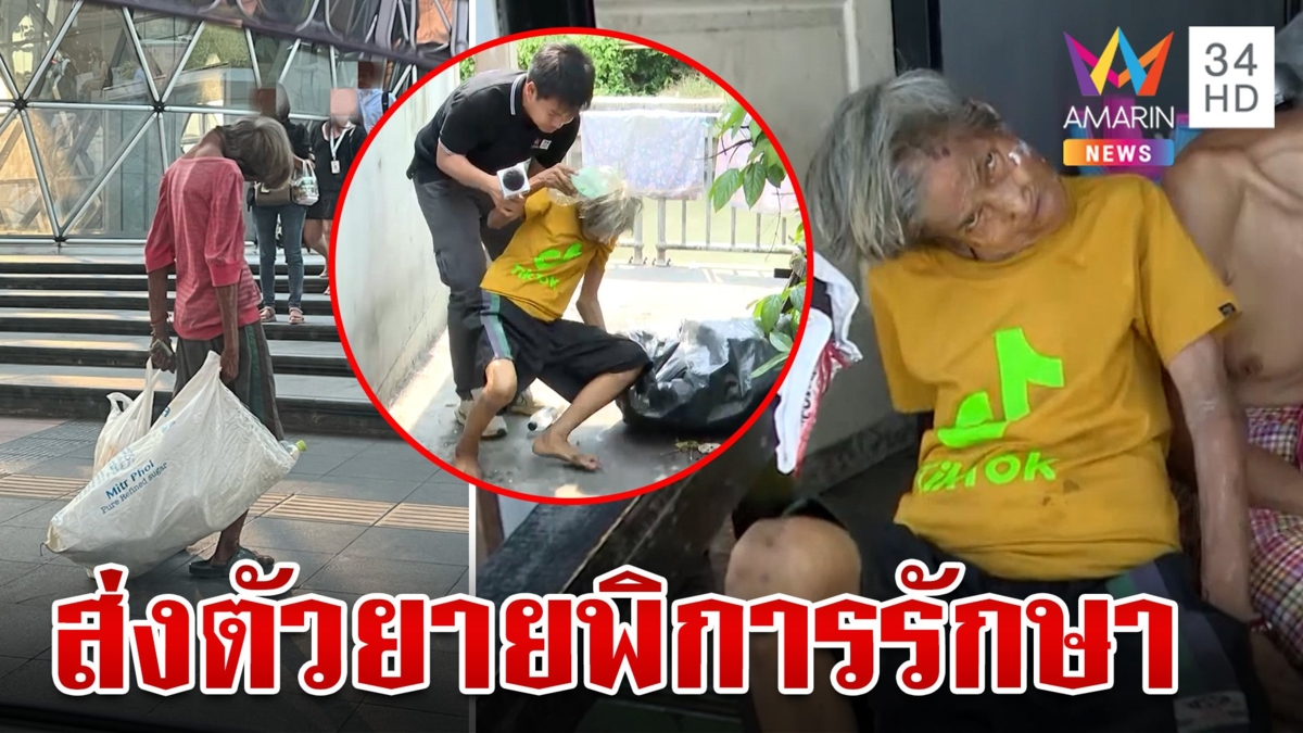 รุดช่วย ยายพิการกระดูกผิดรูปกล้ามเนื้อคอพับ พม.จ่อส่งรักษาตัว