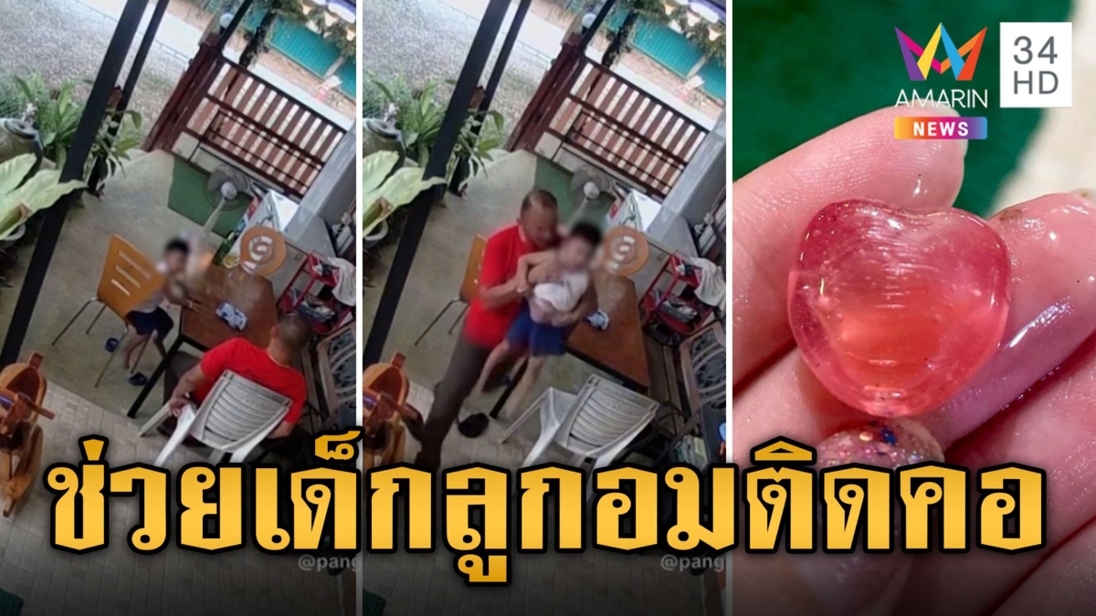 อุทาหรณ์ เด็กกินลูกอมติดคอโชคดีช่วยทัน หวิดกลายเป็นเรื่องร้าย