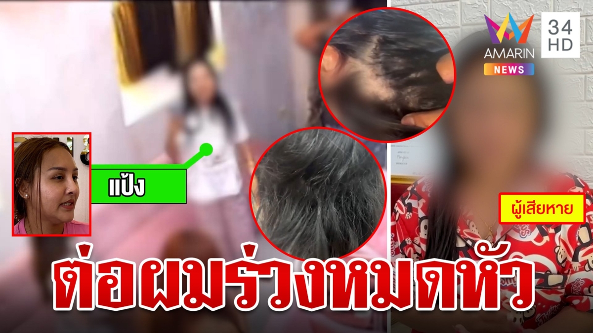 สาวโวยไปต่อผมผ่านไป 5 วัน หัวเกือบล้าน เจ้าของอ้างลูกค้าผมร่วงมาก่อนแล้ว