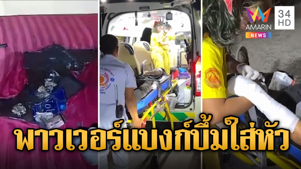 อุทาหรณ์ หนุ่มชาร์จพาวเวอร์แบงก์ไว้ใกล้ตัว ระเบิดบึ้มใส่หน้าไหม้
