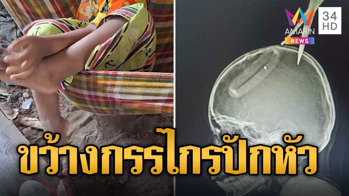 อุทาหรณ์! เด็ก 4 ขวบ ขว้างกรรไกรปักหัวพี่สาว เลียนแบบละครจักรๆ วงศ์ๆ