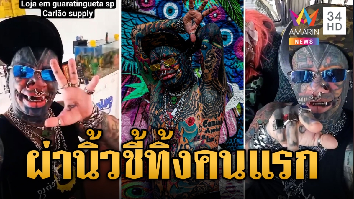 หนุ่มมือปีศาจ ผ่าตัดนิ้วชี้ทิ้ง ลั่นเป็นคนแรกของโลก