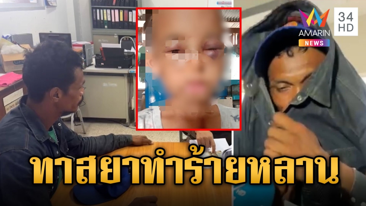 ลุงเขยทาสยา ทำร้ายหลานวัย 5 ขวบ แผลเต็มตัวไม่เหลือที่ว่าง ซ้ำแก้ผ้าหลานขังห้องน้ำ