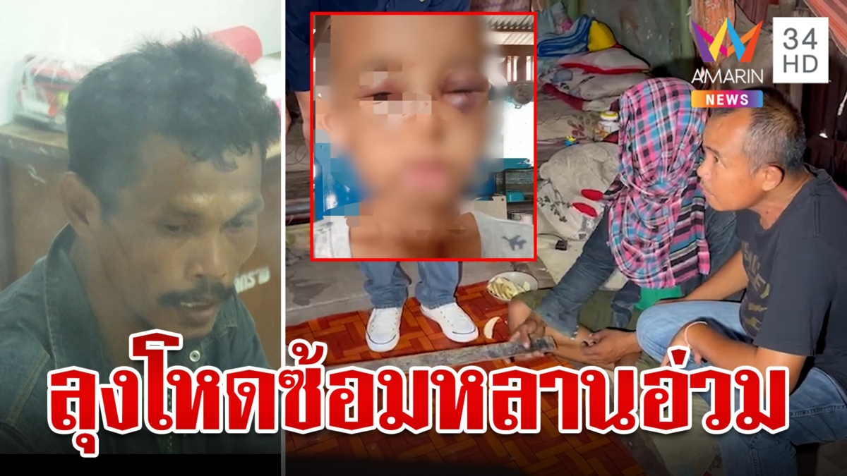 ลุงเขยทาสยาทำร้ายหลาน 5 ขวบ จับขัง-ซ้อมอ่วม บังคับอดข้าวอดน้ำ