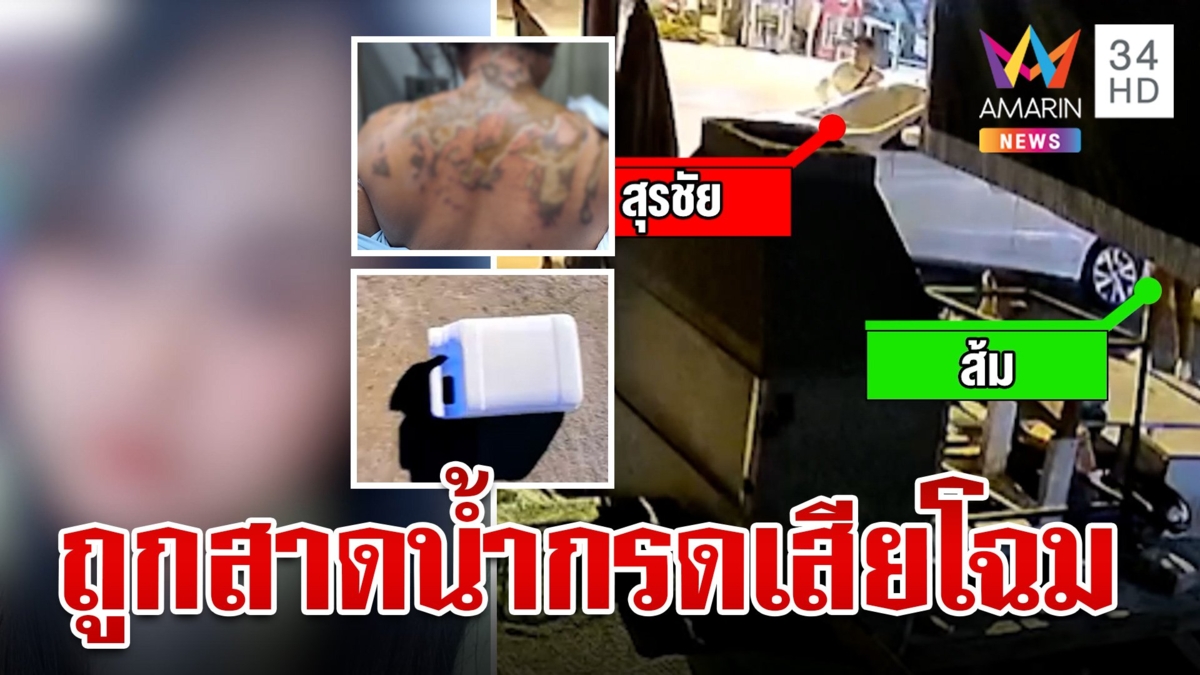 หนุ่มผีพนันโหดตามง้อแฟนไม่สำเร็จ สาดน้ำกรดใส่ให้เสียโฉมเหวอะทั้งร่าง