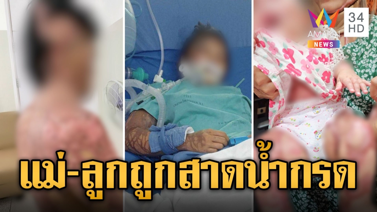 กัน จอมพลัง บุกช่วยแม่-ลูก ถูกเมียเก่าผัวสาดน้ำกรดใส่เละทั้งตั้ว