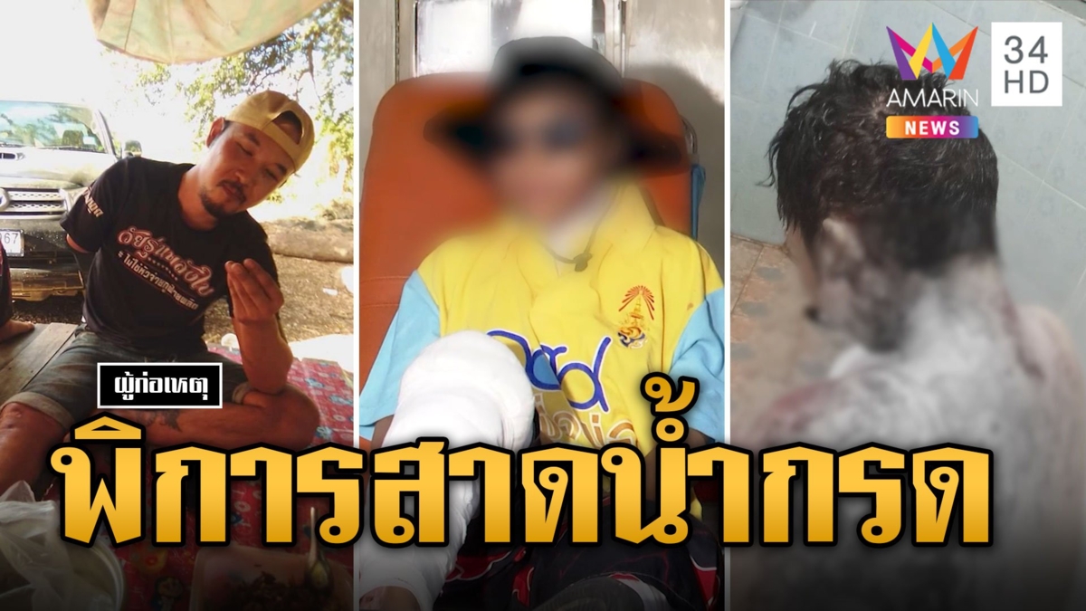 หนุ่มพิการเหี้ยม สาวตีตัวห่างสาดน้ำกรดใส่ทั้งตัว