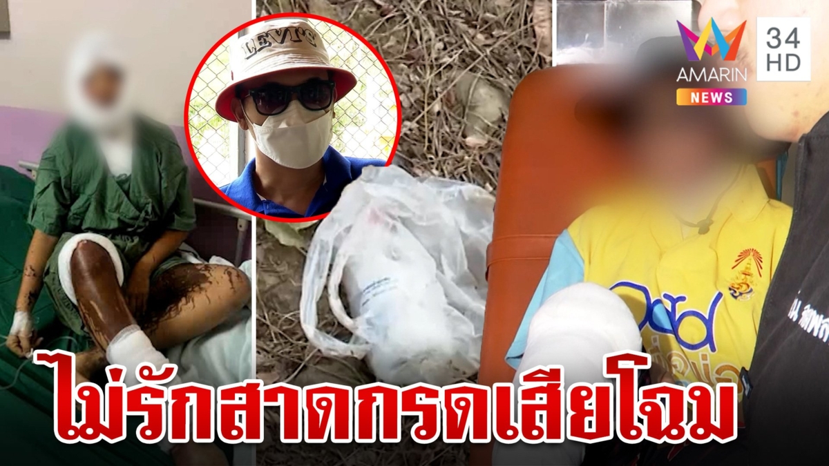 หนุ่มพิการเหี้ยมสาดน้ำกรดแฟนเก่า ฉุนขอเลิกซ้ำควงใหม่หยามหน้า