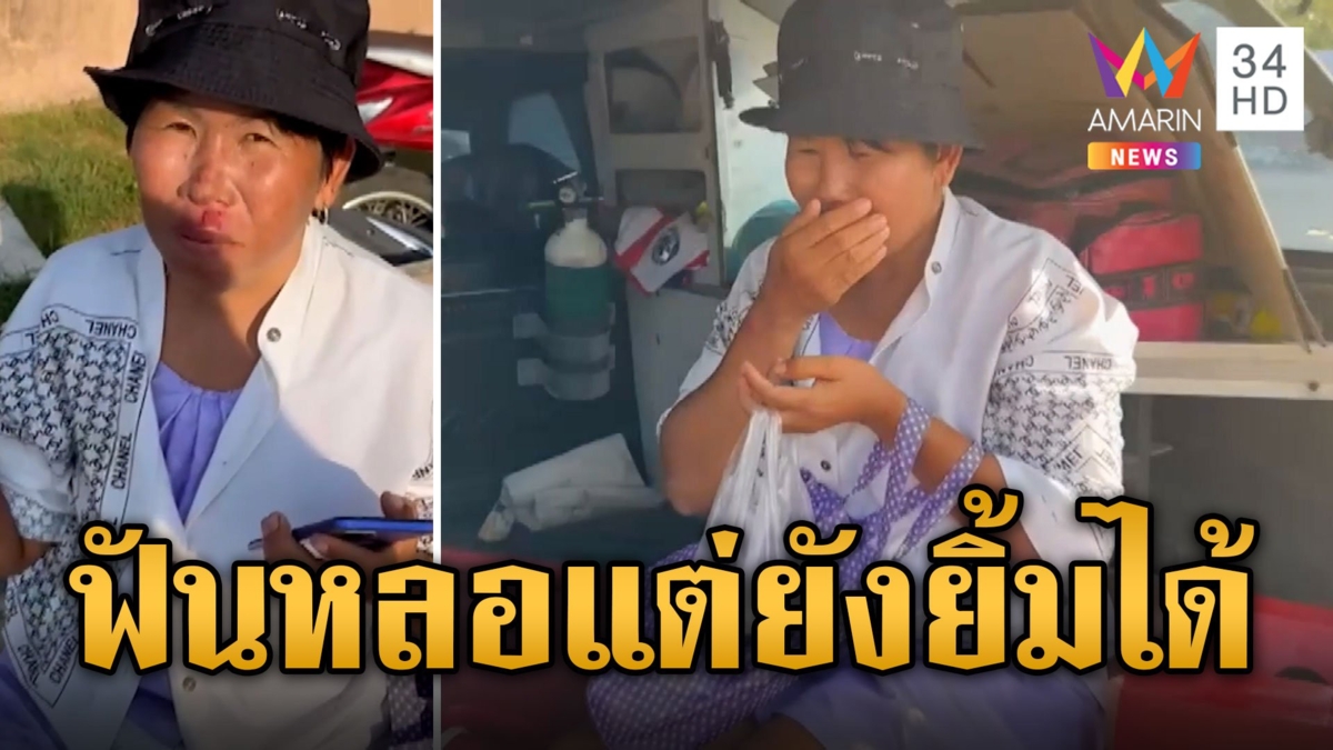 สาวไปทำสวยขี่ จยย.ล้มฟันหลุด นั่งขำตัวเอง