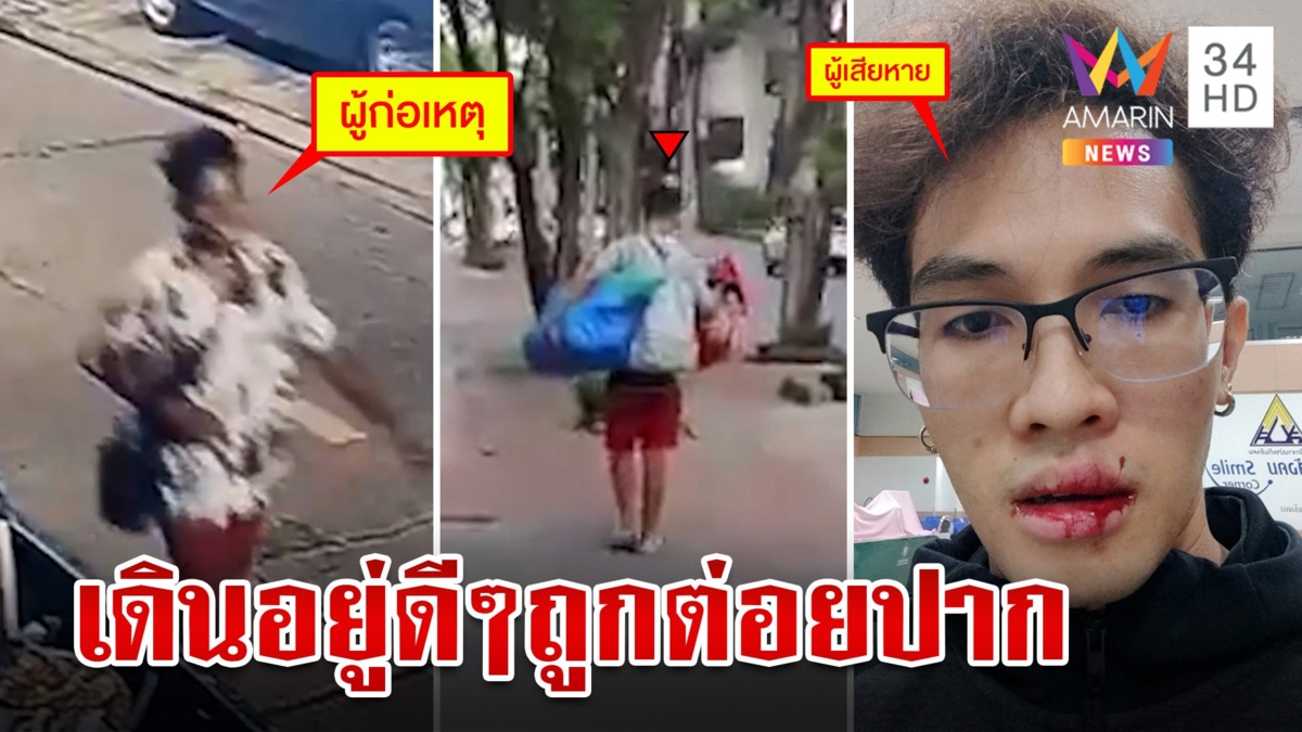 สุดงง!หนุ่มเดินมาเฉยๆเจอคนบ้าต่อยปากแตก แจ้งตร.ได้คำตอบสุดอึ้ง