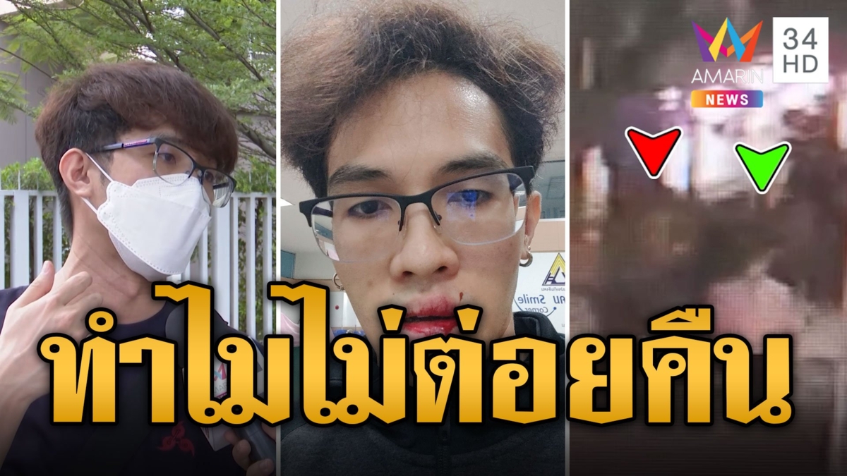 หนุ่มสุดงง! โดนต่อยหน้าหงาย ตร.ถามทำไมไม่สู้กลับ
