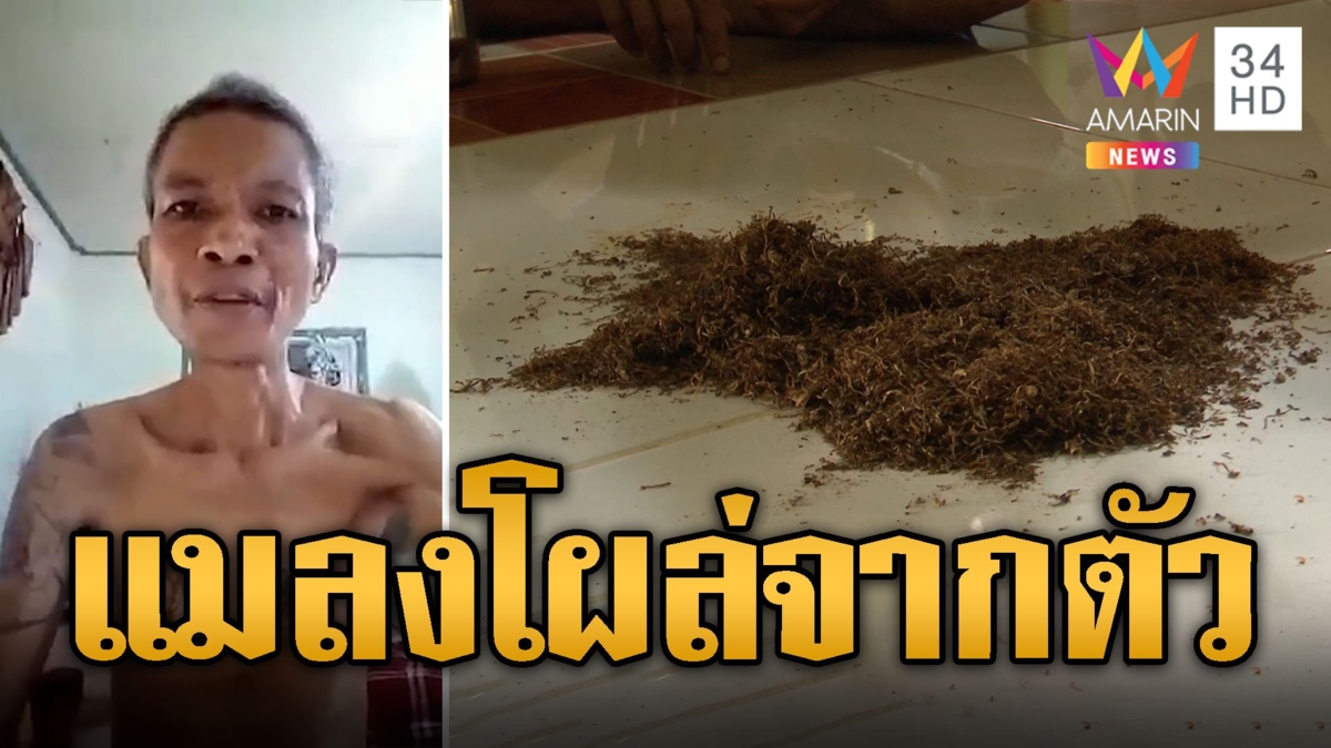 หนุ่มวอน 'หมอปลา' ช่วยด้วยมีแมลงโผล่จากตัวจนตัวผอมซูบ