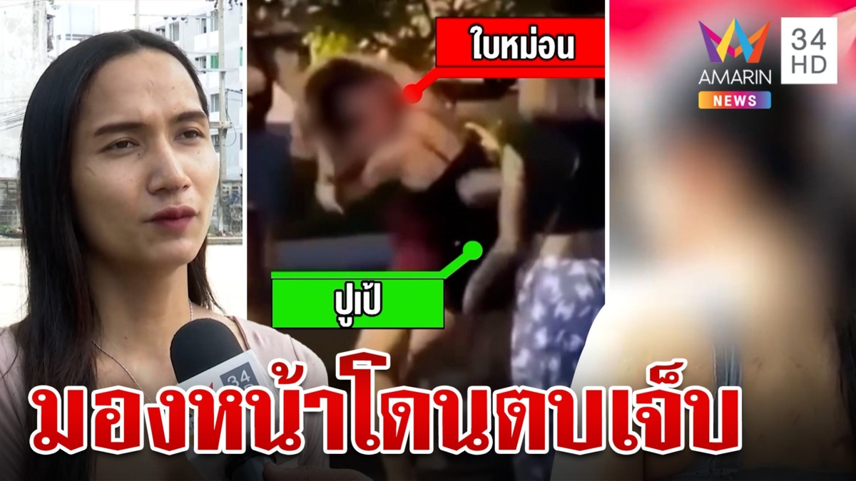 ศึกพี่กะเทยกลางสุขุมวิท แค่มองหน้าจิกหัว-ตบหน้าแหก จมูกฉีกเย็บ 3 เข็ม