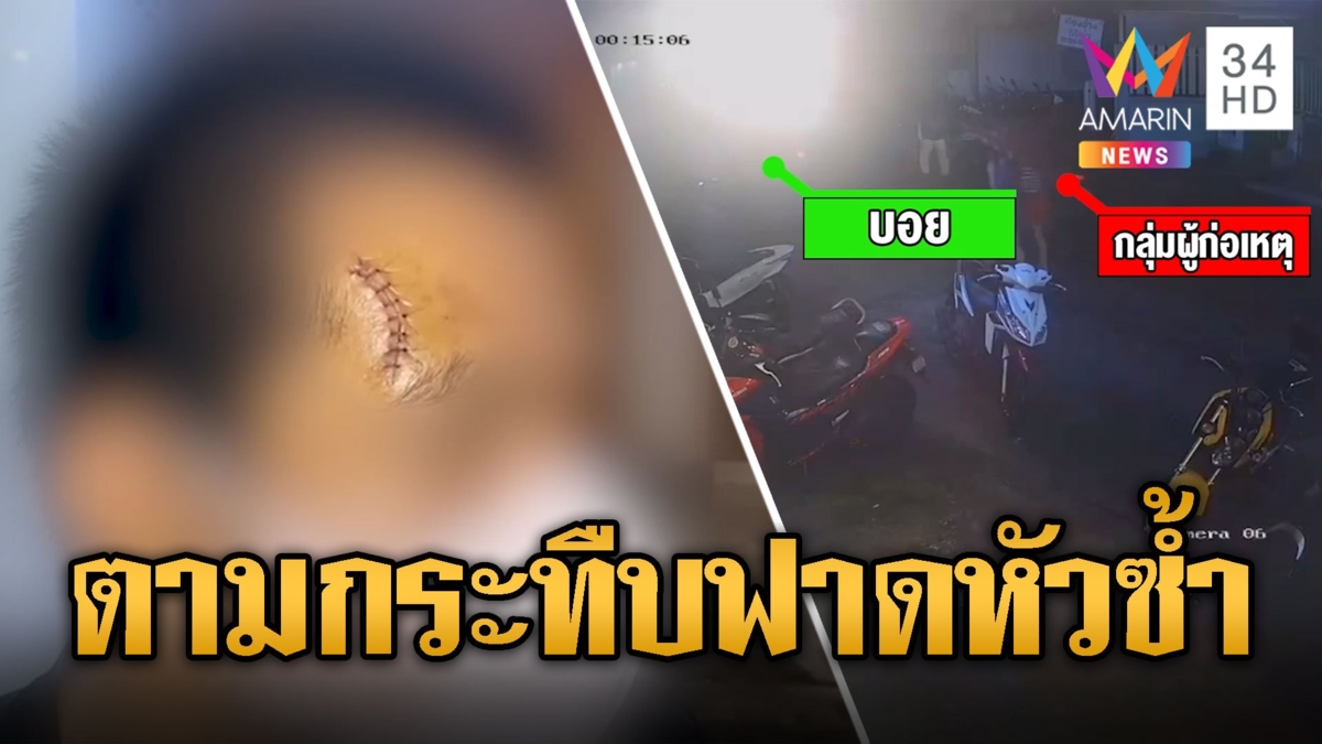 หนุ่มร้อง ถูกประกบรุมกระทืบ เหล็กฟาดหัวน่วม