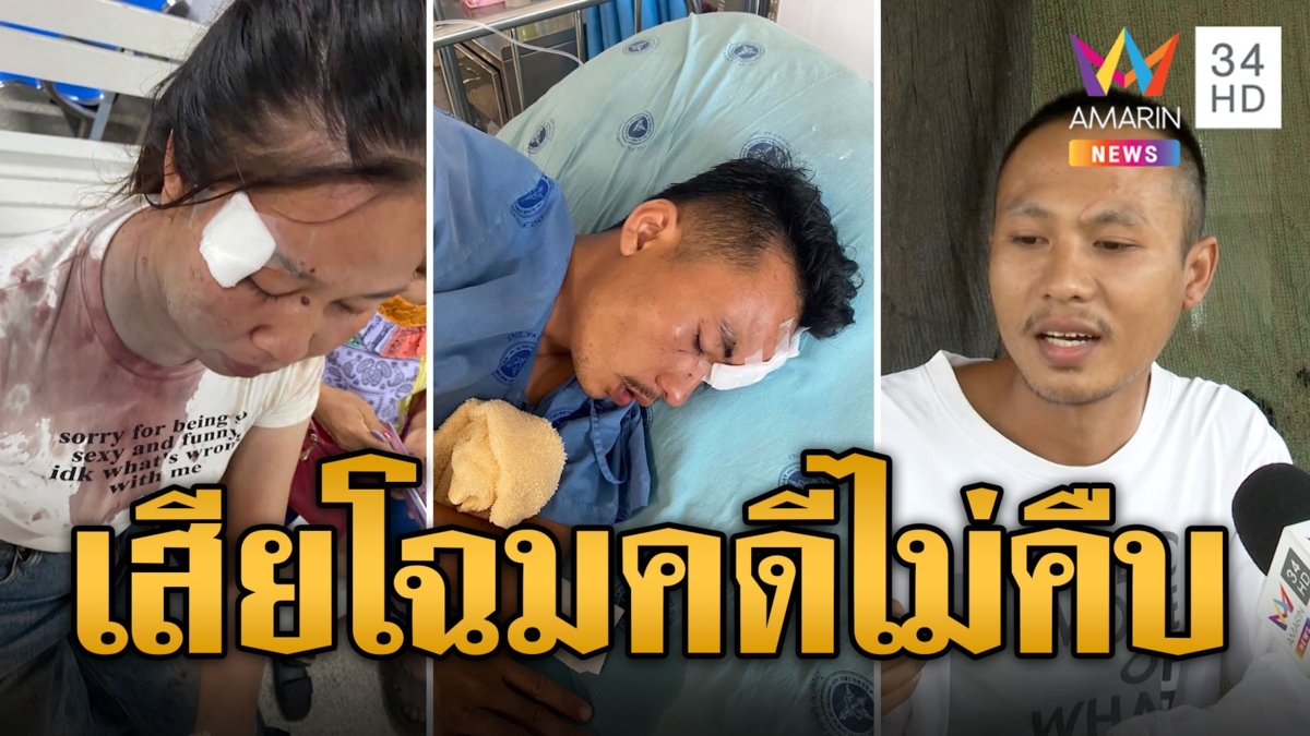 สาวถูกขวดฟาดหน้าเสียโฉม คดีไม่คืบ เอาผิดคนทำไม่ได้